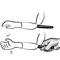 Elbow Rod Arm Option